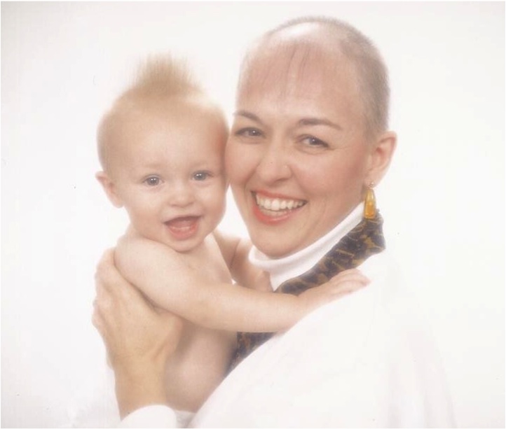 1996-06-01 Balding